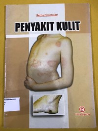 Image of Penyakit kulit